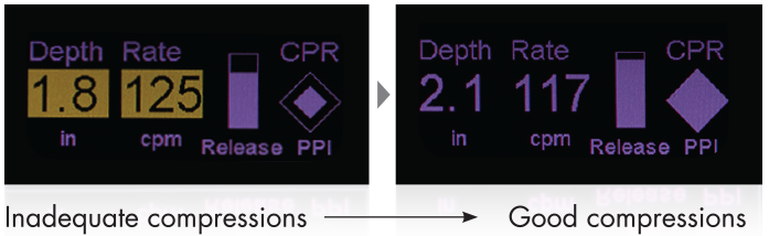 CPR Feedback