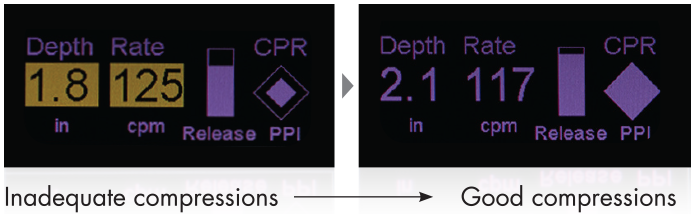 CPR Dashboard: CPR Feedback Device - ZOLL Medical