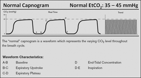 ch 15 what points on a capnographic waveform represens a misture of alveolar gas and dead space gas
